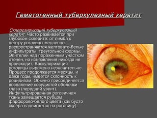 Гематогенный туберкулезный кератит

Склерозирующий туберкулезный
кератит. Часто развивается при
глубоком склерите: от лимба к
центру роговицы медленно
распространяются желтовато-белые
инфильтраты треугольной формы.
Эпителий над пораженным участком
отечен, но изъязвления никогда не
происходит. Васкуляризация
роговицы выражена незначительно.
Процесс продолжается месяцы, и
даже годы, имеется склонность к
рецидивам. Обычно присоединяется
воспаление сосудистой оболочки
глаза (передний увеит).
Инфильтрированная роговичная
ткань замещается рубцом
фарфорово-белого цвета (как будто
склера надвигается на роговицу).
 
