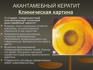 АКАНТАМЕБНЫЙ КЕРАТИТ
            Клиническая картина
    II стадия: поверхностный
    эпителиальный точечный
    акантамебный кератит.
   Размеры зоны поражения остаются
    прежними, но интенсивность
    изменений в ней нарастает.
   Появляются многочисленные
    точечные эпителиальные
    образования, возвышающиеся над
    поверхностью, беловатого или серого
    цвета.
   Возможно формирование
    псевдодендритических линий, борозд,
    что может послужить причиной
    ошибочного диагноза герпетического
    кератита.
   Поверхность роговицы неравномерна,
    имеет шероховатый вид.
 