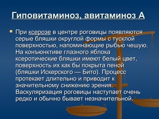 Гиповитаминоз, авитаминоз А
   При ксерозе в центре роговицы появляются
    серые бляшки округлой формы с тусклой
    поверхностью, напоминающие рыбью чешую.
    На конъюнктиве глазного яблока
    ксеротические бляшки имеют белый цвет,
    поверхность их как бы покрыта пеной
    (бляшки Искерского — Бито). Процесс
    протекает длительно и приводит к
    значительному снижению зрения.
    Васкуляризация роговицы наступает очень
    редко и обычно бывает незначительной.
 