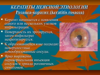 КЕРАТИТЫ НЕЯСНОЙ ЭТИОЛОГИИ
         Розацеа-кератит (keratitis rosacea)
   Кератит начинается с появления
    одного или нескольких узелков
    инфильтрации.
   Поверхность их эрозируется,
    затем инфильтрат
    некротизируется.
   К образовавшейся язве подходят
    поверхностные
    новообразованные сосуды.
   Ярко выражены
    перикорнеальная инъекция
    сосудов и триада роговичных
    симптомов.
 