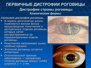ПЕРВИЧНЫЕ ДИСТРОФИИ РОГОВИЦЫ
            Дистрофия стромы роговицы
                   Клинические формы
Узелковая дистрофия роговицы.
 В первом десятилетии жизни

  появляются мелкие белые
  крошковидные помутнения в
  центральных отделах роговицы,
  которые затем
  распространяются на
  парацентральные отделы
  роговицы.
 Помутнения напоминают сухие

  хлебные крошки.
 Эпителий роговицы остается

  интактным.
 Отличительный признак

  заболевания — прозрачная
  полоска роговицы вокруг лимба
  шириной 2 — 3 мм.
 