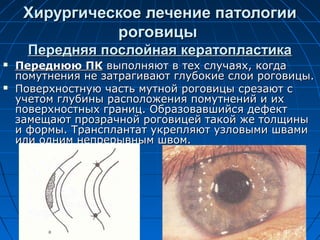 Хирургическое лечение патологии
               роговицы
      Передняя послойная кератопластика
   Переднюю ПК выполняют в тех случаях, когда
    помутнения не затрагивают глубокие слои роговицы.
   Поверхностную часть мутной роговицы срезают с
    учетом глубины расположения помутнений и их
    поверхностных границ. Образовавшийся дефект
    замещают прозрачной роговицей такой же толщины
    и формы. Трансплантат укрепляют узловыми швами
    или одним непрерывным швом.
 