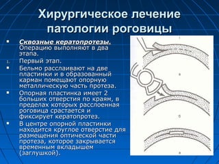Хирургическое лечение
           патологии роговицы
    Сквозные кератопротезы.
     Операцию выполняют в два
     этапа.
1.   Первый этап.
    Бельмо расслаивают на две
     пластинки и в образованный
     карман помещают опорную
     металлическую часть протеза.
    Опорная пластинка имеет 2
     больших отверстия по краям, в
     пределах которых расслоенная
     роговица срастается и
     фиксирует кератопротез.
    В центре опорной пластинки
     находится круглое отверстие для
     размещения оптической части
     протеза, которое закрывается
     временным вкладышем
     (заглушкой).
 