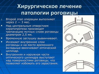 Хирургическое лечение
             патологии роговицы
2.   Второй этап операции выполняют
     через 2 — 3 мес.
    Над центральным отверстием
     кератопротеза производят
     трепанацию мутных слоев роговицы
     диаметром 2,5 мм.
    Временную заглушку вывинчивают.
    Иссекают внутренние слои
     роговицы и на место временного
     вкладыша ввинчивают оптический
     цилиндр.
    Внутренняя и наружная части
     оптического цилиндра выступают
     над поверхностями роговицы, что
     позволяет избежать его зарастания.
 