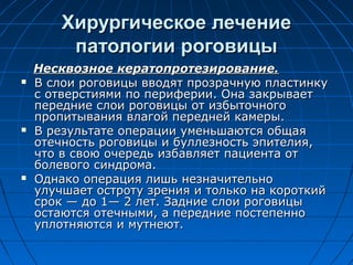 Хирургическое лечение
         патологии роговицы
    Несквозное кератопротезирование.
   В слои роговицы вводят прозрачную пластинку
    с отверстиями по периферии. Она закрывает
    передние слои роговицы от избыточного
    пропитывания влагой передней камеры.
   В результате операции уменьшаются общая
    отечность роговицы и буллезность эпителия,
    что в свою очередь избавляет пациента от
    болевого синдрома.
   Однако операция лишь незначительно
    улучшает остроту зрения и только на короткий
    срок — до 1— 2 лет. Задние слои роговицы
    остаются отечными, а передние постепенно
    уплотняются и мутнеют.
 