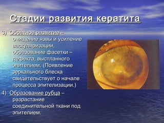 Стадии развития кератита
3) Обратное развитие –
    очищение язвы и усиление
    васкуляризации,
    образование фасетки –
    дефекта, выстланного
    эпителием. (Появление
    зеркального блеска
    свидетельствует о начале
    процесса эпителизации.)
4) Образование рубца –
    разрастание
    соединительной ткани под
    эпителием.
 