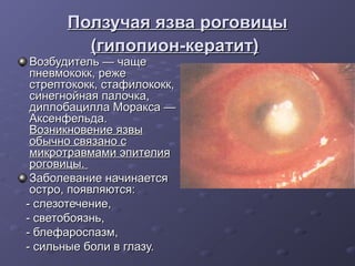 Ползучая язва роговицы
         (гипопион-кератит)
 Возбудитель — чаще
 пневмококк, реже
 стрептококк, стафилококк,
 синегнойная палочка,
 диплобацилла Моракса —
 Аксенфельда.
 Возникновение язвы
 обычно связано с
 микротравмами эпителия
 роговицы.
 Заболевание начинается
 остро, появляются:
- слезотечение,
- светобоязнь,
- блефароспазм,
- сильные боли в глазу.
 