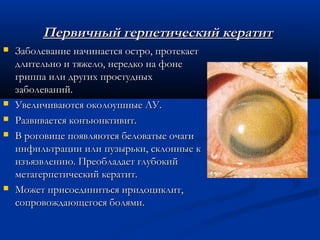 Первичный герпетический кератит
   Заболевание начинается остро, протекает
    длительно и тяжело, нередко на фоне
    гриппа или других простудных
    заболеваний.
   Увеличиваются околоушные ЛУ.
   Развивается конъюнктивит.
   В роговице появляются беловатые очаги
    инфильтрации или пузырьки, склонные к
    изъязвлению. Преобладает глубокий
    метагерпетический кератит.
   Может присоединиться иридоциклит,
    сопровождающегося болями.
 