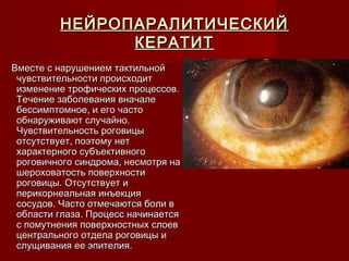 НЕЙРОПАРАЛИТИЧЕСКИЙ
               КЕРАТИТ
Вместе с нарушением тактильной
 чувствительности происходит
 изменение трофических процессов.
 Течение заболевания вначале
 бессимптомное, и его часто
 обнаруживают случайно.
 Чувствительность роговицы
 отсутствует, поэтому нет
 характерного субъективного
 роговичного синдрома, несмотря на
 шероховатость поверхности
 роговицы. Отсутствует и
 перикорнеальная инъекция
 сосудов. Часто отмечаются боли в
 области глаза. Процесс начинается
 с помутнения поверхностных слоев
 центрального отдела роговицы и
 слущивания ее эпителия.
 