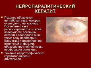 НЕЙРОПАРАЛИТИЧЕСКИЙ
                 КЕРАТИТ
   Позднее образуется
    неглубокая язва, которая
    очень долго не заживает.
    Постепенно язва
    распространяется по всей
    поверхности роговицы,
    оставляя свободной лишь
    узкую зону периферии.
    Возможны присоединение
    вторичной инфекции,
    образование гнойной язвы,
    перфорация роговицы.
   Течение нейротрофических
    кератитов вялое и
    длительное.
 