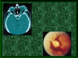 измен.дзн при нек-общ