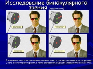 Исследование бинокулярного
       зрения                          (продолжение)




В зависимости от ответов пациента можно точно установить наличие или отсутствие
у него бинокулярного зрения, а также определить ведущий (правый или левый) глаз.
 