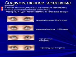 Содружественное косоглазие
Проявления:
Как правило, постоянный угол девиации нефиксирующего (косящего) глаза;
Сохранение движений косящего глаза в полном объеме;
  Классификация содружественного косоглазия по направлению девиации:



                                   сходящееся (эзотропия) – 70-80% случаев;




                                  расходящееся (экзотропия) – 15-20% случаев;




                                      суправергирующее
                                      (гипертропия);



                                       инфравергирующее (гипотропия);
 