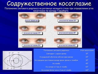 Содружественное косоглазие
Положение светового рефлекса на роговице косящего глаза при определении угла
                       косоглазия по методу Гиршберга




                                   Положение светового рефлекса               Угол косоглазия

                                      Совпадает с краем зрачка                      15°

                              На радужной оболочке вблизи края зрачка              20°

                         На середине расстояния между краем зрачка и лимбом        30°

                                             На лимбе                              45°

                                     На склере в 3 мм от лимба                     60°

                                На склере более чем в 3 мм от лимба                >60°
 