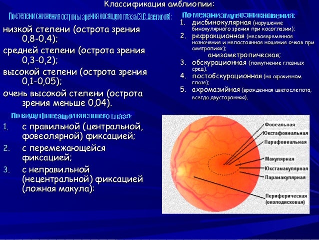 Можно ли работать фотографом с плохим зрением