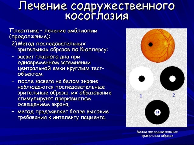 Упражнение для глаз восстановление близорукости