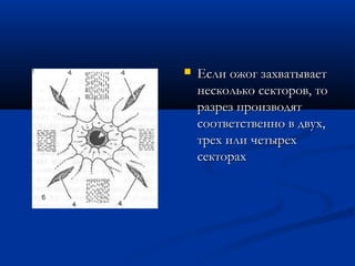    Если ожог захватывает
    несколько секторов, то
    разрез производят
    соответственно в двух,
    трех или четырех
    секторах
 