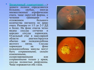  Врожденный хориоретинит – у
  заднего полюса определяются
  большие,     грубые,     иногда
  множественные атрофические
  очаги, чаще округлой формы, с
  четкими       границами       и
  отложением            большого
  количества пигмента по краю
  очага. Размеры от 1/3 до 2-3 ДД
  и более. На фоне очагов четко
  видны сосуды сетчатки и
  нередко сосуды хориоидеи.
  Отдельный очаг в макулярной
  области         диагностируется
  обычно как псевдоколобома
  желтого      пятна.     Сосуды
  хориоидеи         на       фоне
  псевдоколобомы макулы могут
  быть сохраненными; сильно
  измененными,
  склерозированными           или
  сохраненными только у краев;
  сосуды полностью разрушены.
  Чаще поражаются оба глаза.
 