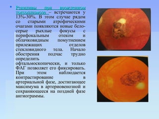  Рецидивы     при    врожденном
  токсоплазмозе – встречаются у
  13%-30%. В этом случае рядом
  со    старыми    атрофическими
  очагами появляются новые бело-
  серые     рыхлые    фокусы    с
  перифокальным      отеком     и
  облачковидным      помутнением
  прилежащих              отделов
  стекловидного тела. Начало
  обострения     подчас    трудно
  определить
  офтальмоскопически, и только
  ФАГ позволяет его фиксировать.
  При       этом      наблюдается
  контрастирование              в
  артериальной фазе, достигающее
  максимума в артериовенозной и
  сохраняющееся на поздней фазе
  ангиограммы.
 