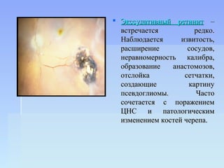  Экссудативный ретинит –
  встречается          редко.
  Наблюдается      извитость,
  расширение         сосудов,
  неравномерность калибра,
  образование   анастомозов,
  отслойка          сетчатки,
  создающие          картину
  псевдоглиомы.        Часто
  сочетается с поражением
  ЦНС и патологическим
  изменением костей черепа.
 