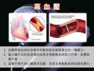 1. 血壓是指血液在血管內流動時對血管壁產生的一種壓力。
2. 當心臟打出的血液增加或是全身動脈系統阻力升高，血壓就
   會升高。
3. 血壓升高代表心臟負荷加重，或是全身動脈系統收縮或硬化。
 