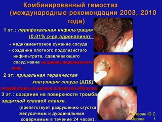 Комбинированный гемостаз
   (международные рекомендации 2003, 2010
                 года)
1 эт.: перифокальная инфильтрация
           (0,01% р-ра адреналина):
   - медикаментозное сужение сосуда
   - создание плотного подслизистого
      инфильтрата, сдавливающего
      сосуд извне на уровне подслизистого
     слоя.
2 эт: прицельная термическая
            коагуляция сосуда (АПК)
воздействие на уровне слизистой оболочки
3 эт.: создание на поверхности тромба
защитной клеевой пленки ,
       (препятствует разрушению сгустка
       желудочным и дуоденальным            Тетерин Ю.С.
        содержимым в течение 24 часов).     Москва    1
 