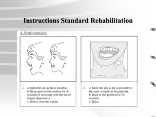 Instructions Standard Rehabilitation
 
