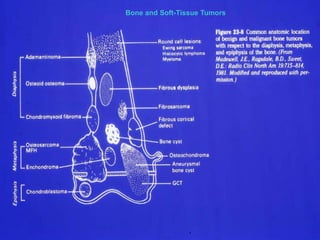 Block 7: Musculoskeletal System
                                  Bone and Soft-Tissue Tumors




  4
 