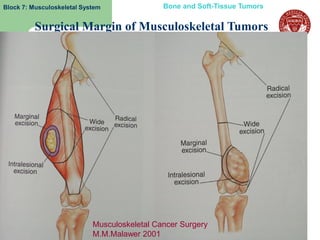 Block 7: Musculoskeletal System               Bone and Soft-Tissue Tumors


          Surgical Margin of Musculoskeletal Tumors




                            Musculoskeletal Cancer Surgery
  6                         M.M.Malawer 2001
 