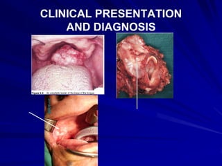 CLINICAL PRESENTATION
    AND DIAGNOSIS
 