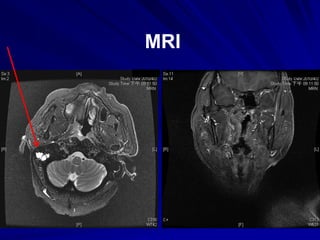 MRI
 