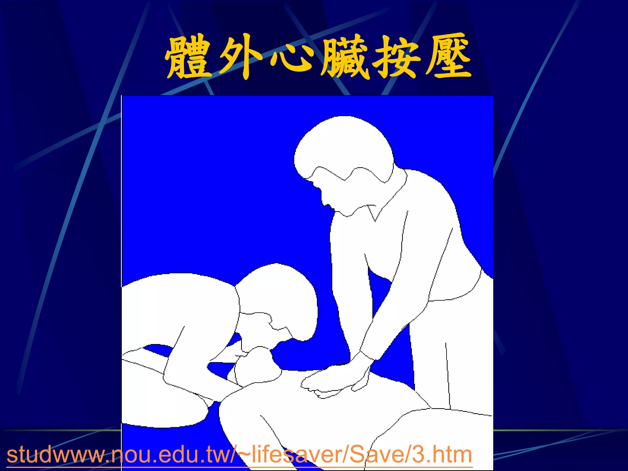 體外心臟按壓




studwww.nou.edu.tw/~lifesaver/Save/3.htm
 