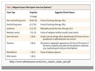 26




http://www.aboutcancer.com/svco_cuases_nejm_507.gif
 