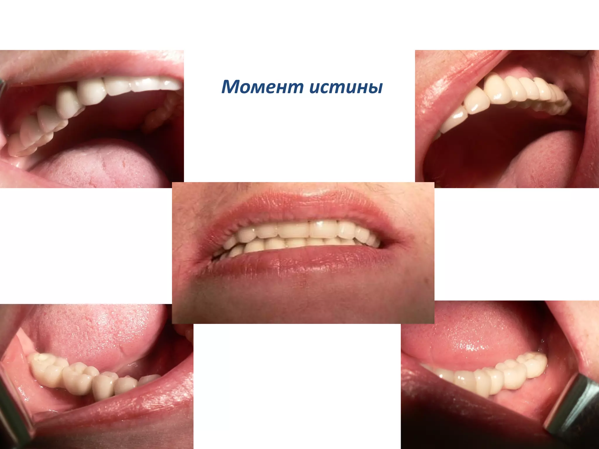 Момент истины
 