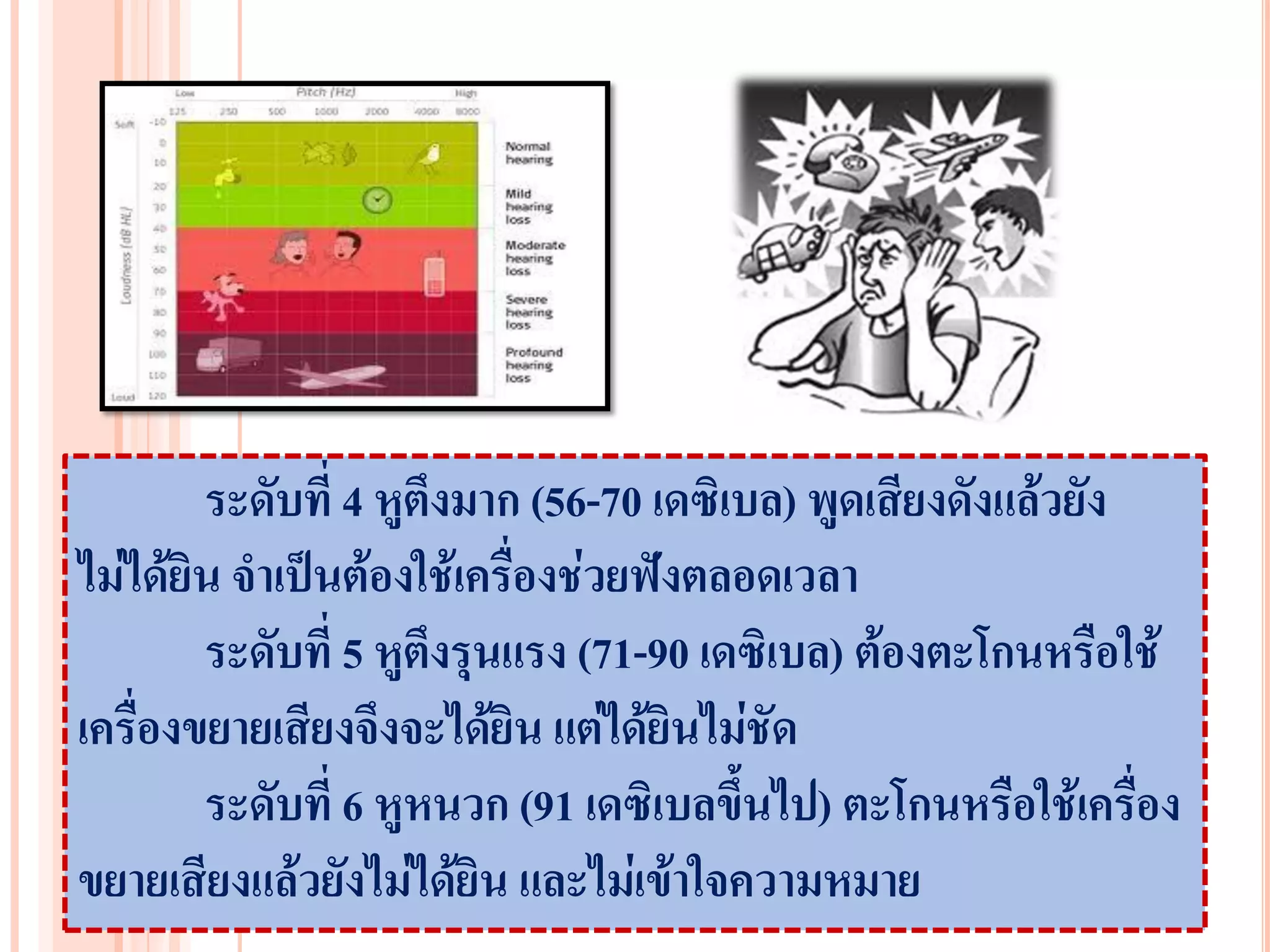 ระดับที่ 4 หูตึงมาก (56-70 เดซิเบล) พูดเสียงดังแล้วยัง
ไม่ได้ยิน จาเป็นต้องใช้เครื่องช่วยฟังตลอดเวลา
        ระดับที่ 5 หูตึงรุนแรง (71-90 เดซิเบล) ต้องตะโกนหรือใช้
เครื่องขยายเสียงจึงจะได้ยิน แต่ได้ยินไม่ชัด
        ระดับที่ 6 หูหนวก (91 เดซิเบลขึ้นไป) ตะโกนหรือใช้เครื่อง
ขยายเสียงแล้วยังไม่ได้ยิน และไม่เข้าใจความหมาย
 