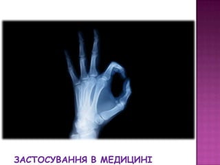 ентген