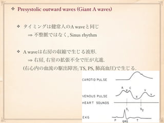 Presystolic outward waves (Giant A waves) 


  タイミングは健常人のA waveと同じ
   ⇒ 不整脈ではなく, Sinus rhythm


  A waveは右房の収縮で生じる波形.
   ⇒ 右房, 右室の拡張不全で圧が亢進.
  (右心内の血流の駆出障害; TS, PS, 肺高血圧)で生じる.
 