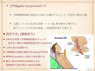 JVP(Jugular vein pressure)とは


        内頸静脈拍動の最高点の高さを測定することで, 右房圧が推定可能.


        亢進していれば右房圧高値 → うっ血, 肺水腫を示唆する.
        低下していれば右房圧低値 → 低循環状態を示唆する.

   測定方法; (動画あり)
   仰臥位の状態で内頸静脈拍動をチェック
     認めない場合は頸静脈虚脱(JVP<5cmH2O)
   上体を30-45度傾ける
   内頸静脈の拍動の最高点をCheck(呼気時)
   胸骨柄(Louis角)との高さの差を調べる
   高さ+5cmがJVP(cmH2O)となる
    (胸骨柄が心房の高さ+5cmの位置)
 
