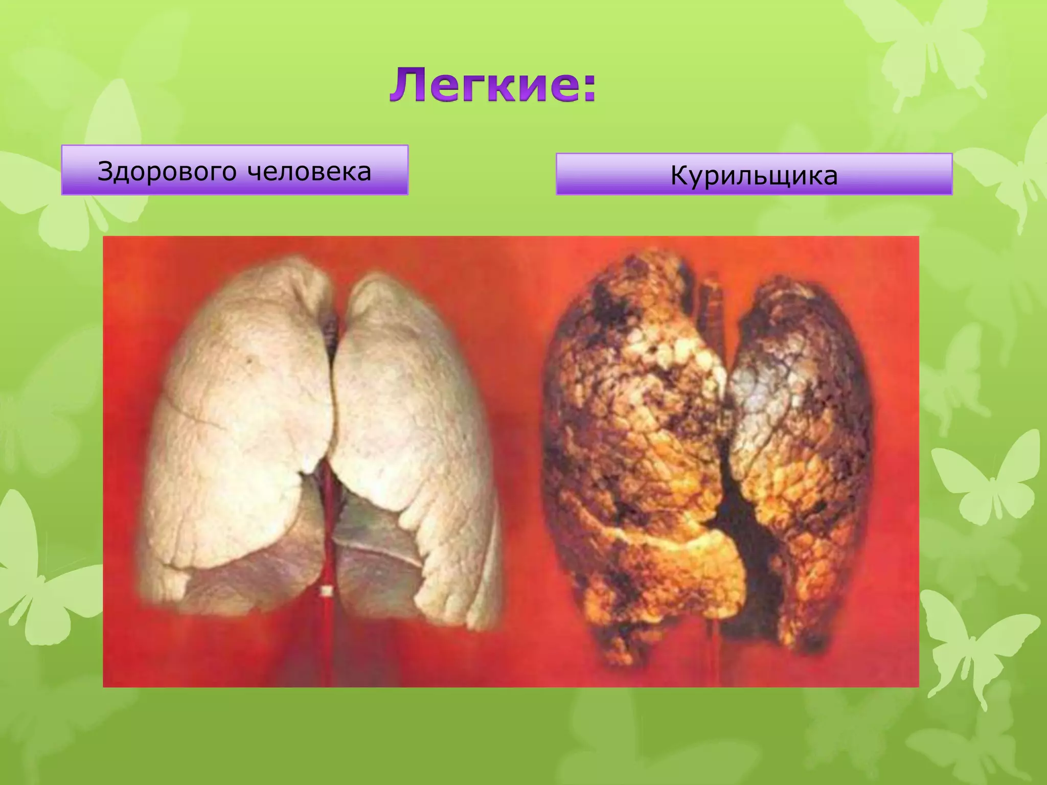 Здорового человека   Курильщика
 