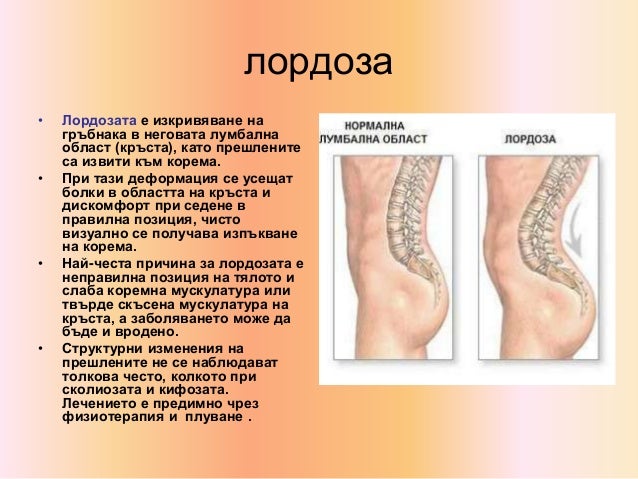 опорно двигателна система