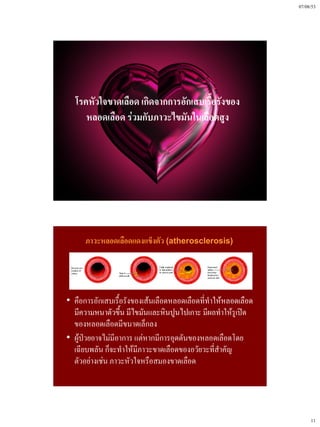 07/08/53




  โรคหัวใจขาดเลือด เกิดจากการอักเสบเรื้อรังของ
     หลอดเลือด ร่วมกับภาวะไขมันในเลือดสูง




      ภาวะหลอดเลือดแดงแข็งตัว (atherosclerosis)




• คือการอักเสบเรื้อรังของเส้นเลือดหลอดเลือดที่ทําให้หลอดเลือด
  มีความหนาตัวขึ้น มีไขมันและหินปูนไปเกาะ มีผลทําให้รูเปิด
  ของหลอดเลือดมีขนาดเล็กลง
• ผู้ป่วยอาจไม่มีอาการ แต่หากมีการอุดตันของหลอดเลือดโดย
  เฉียบพลัน ก็จะทําให้มีภาวะขาดเลือดของอวัยวะที่สําคัญ
  ตัวอย่างเช่น ภาวะหัวใจหรือสมองขาดเลือด




                                                                     11
 