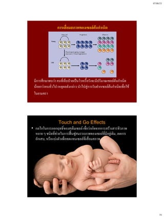 07/08/53




                  การเสื่อมสภาพของเซลล์ต้นกําเนิด




 มีการศึกษาพบว่า คนที่เจ็บป่วยเป็นโรคเรื้อรังจะมีปริมาณเซลล์ต้นกําเนิด
 น้อยกว่าคนทั่วไป เหตุผลดังกล่าว นําไปสู่การรับฝากเซลล์ต้นกําเนิดเพื่อใช้
 ในยามชรา




                   Touch and Go Effects
• กลไกในการออกฤทธิ์ของสเต็มเซลล์ เชื่อว่าเกิดจากการสร้างสารชีวภาพ
  หลาย ๆ ชนิดที่ช่วยในการฟื้นฟูสมรรถภาพของเซลล์ที่มีอยู่เดิม, ลดการ
  อักเสบ, หรือแบ่งตัวเพื่อทดแทนเซลล์ที่เสื่อมสภาพ




                                                                                 16
 
