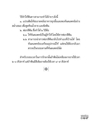 «‘∏∑”„Àâøπ¢“« “¡“√∂∑”‰¥âß“¬Ê ¥—ßπ’È
          ’      í                    à
       Ò. ·ª√ßøíπ„Àâ –Õ“¥À≈—ßÕ“À“√∑ÿ°¡◊Õ·≈–æ∫∑—πµ·æ∑¬åÕ¬à“ß
                                          È
 ¡Ë”‡ ¡Õ ‡æ◊Õ¢Ÿ¥À‘ππÈ”≈“¬ ·≈–¢—¥øíπ
             Ë
       Ú. øÕ° ’øπ ´÷ß∑”‰¥â Ú «‘∏§Õ
                   í Ë          ’ ◊
            Ú.Ò „Àâ∑πµ·æ∑¬å‡ªìπºŸ∑”„Àâ ‚¥¬„™â “√øÕ° ’øπ
                    —            â                    í
            Ú.Ú  “¡“√∂π” “√øÕ° ’øíπ°≈—∫‰ª∑”‡Õß∑’Ë∫â“π‰¥â ‚¥¬
                ∑—πµ·æ∑¬å®–‡µ√’¬¡Õÿª°√≥å„Àâ ·µà§π‰¢âµâÕß°≈—∫¡“
                µ√«®‡ªìπ√–¬–µ“¡∑’∑πµ·æ∑¬åπ¥
                                    Ë —       —

        ”À√—∫√–¬–‡«≈“„π°“√√—°…“π—π∂â“øíπ‰¡à‡À≈◊Õß¡“°Õ“®„™â‡«≈“
                                   È
Ú-Û  —ª¥“Àå ·µà∂“øíπ¡’ ‡¢â¡Õ“®µâÕß„™â‡«≈“ Ù-ı  —ª¥“Àå
                â      ’




                                                                 æ∫À¡Õ»‘√‘√“™
                                                                 Ò˘
 