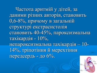Частота аритмій у дітей, за
даними різних авторів, становить
0,6-8%, причому в загальній
структурі екстрасистолія
становить 40-45%, пароксизмальна
тахікардія - 10%,
непароксизмальна тахікардія – 10-
14%, тріпотіння й мерехтіння
передсердь - до 6%.
 