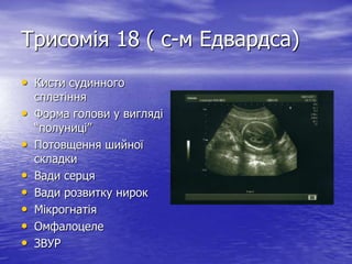 Трисомія 18 ( с-м Едвардса)
• Кисти судинного
    сплетіння
•   Форма голови у вигляді
    “полуниці”
•   Потовщення шийної
    складки
•   Вади серця
•   Вади розвитку нирок
•   Мікрогнатія
•   Омфалоцеле
•   ЗВУР
 