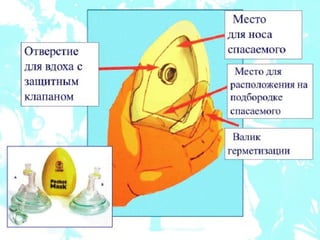 реанимация