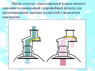 реанимация