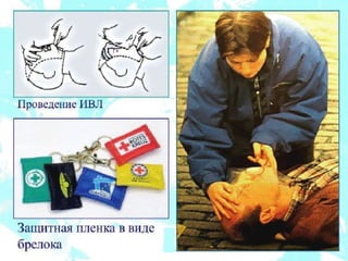 реанимация