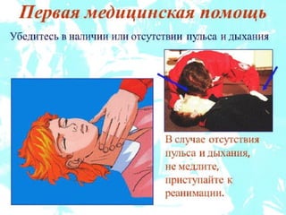реанимация