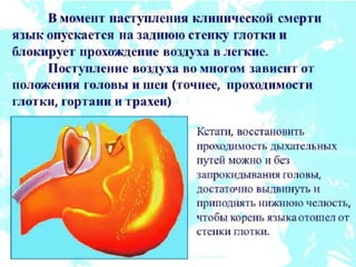 реанимация